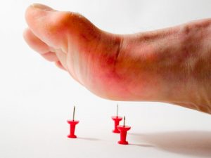 Bệnh gút Bệnh gút