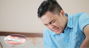 Bệnh gút ở người trẻ benh-gut-o-nguoi-tre